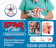 Fibroid Removal Expert Without Surgery by Star Clinic