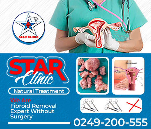Star Clinic flyer showing the clinic logo, a clinician, fibroid illustrations, and contact number 0249-200-555